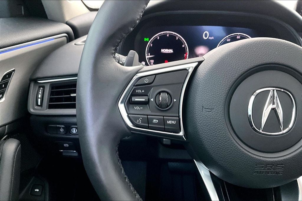 2025 Acura TLX Technology Package