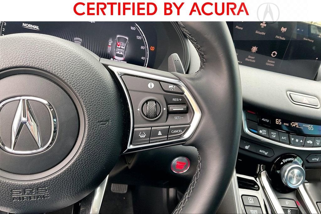 2025 Acura TLX Technology Package