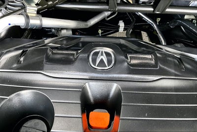 2025 Acura TLX Technology Package
