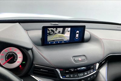 2021 Acura TLX A-Spec Package